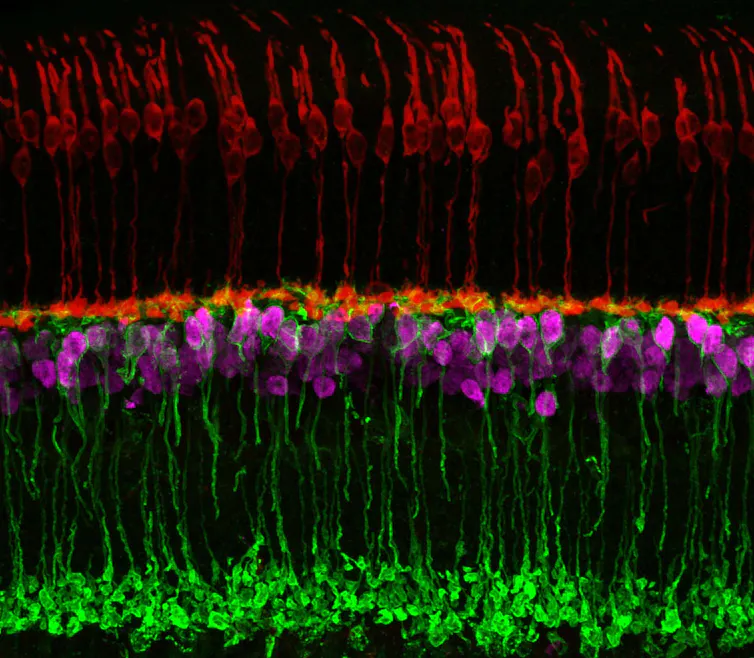 Microscopy image of stacks of neurons