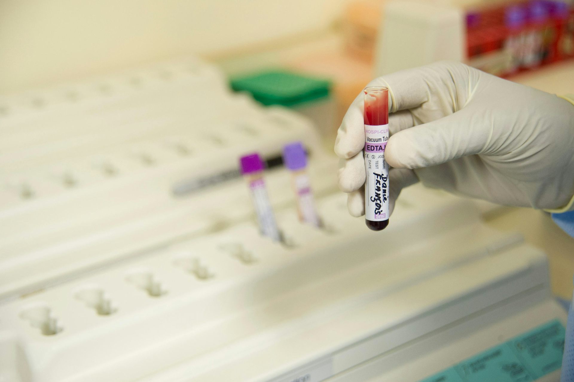 A gloved hand holding a blood sample.