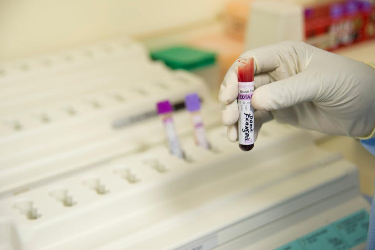 A gloved hand holding a blood sample.