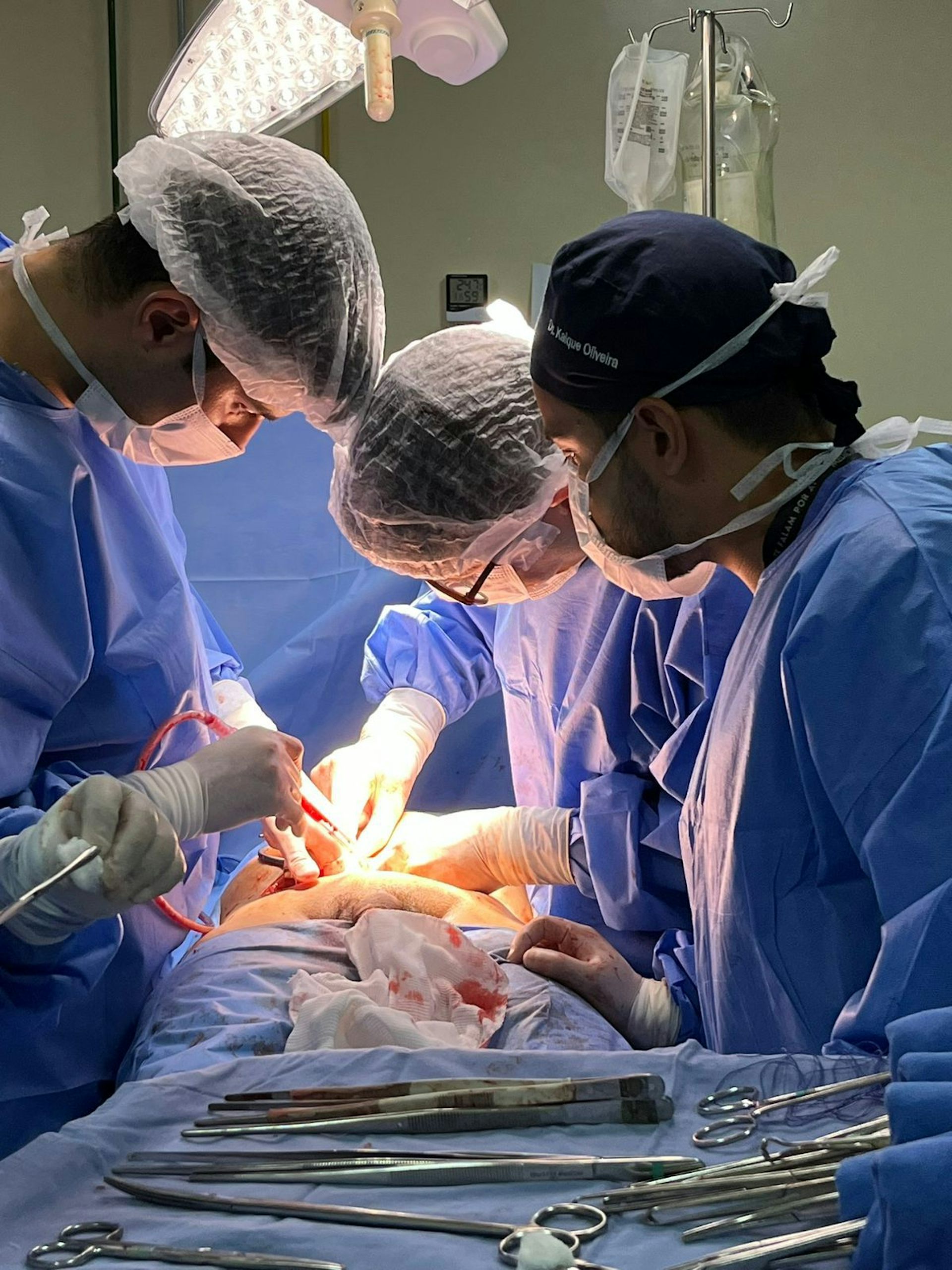 Sem robôs nem altos custos: técnica brasileira inova cirurgia do câncer de próstata no SUS