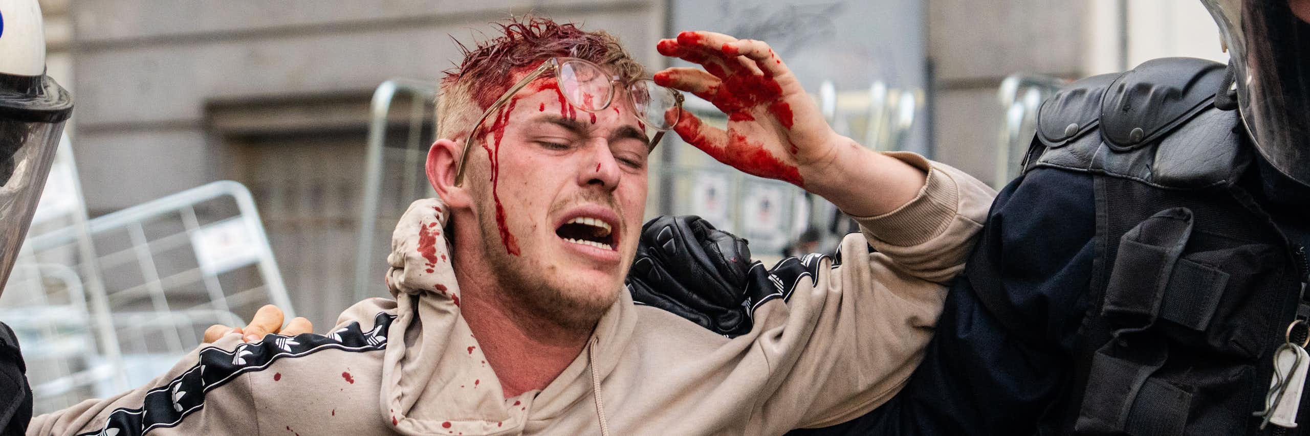 Salvaguardas exigidas pelos agricultores europeus que adiaram acordo UE-Mercosul estão equivocadas