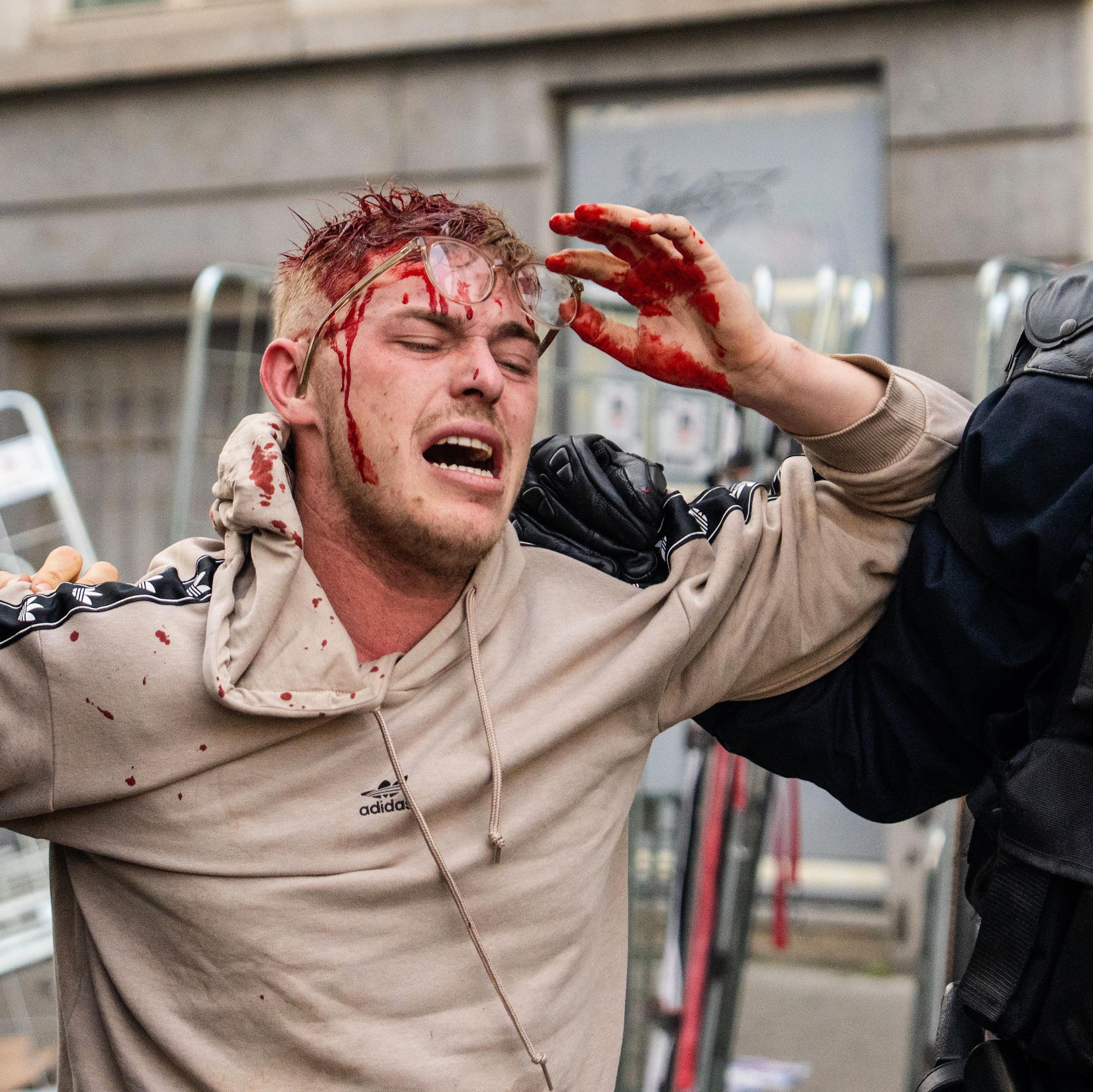 Salvaguardas exigidas pelos agricultores europeus que adiaram acordo UE-Mercosul estão equivocadas