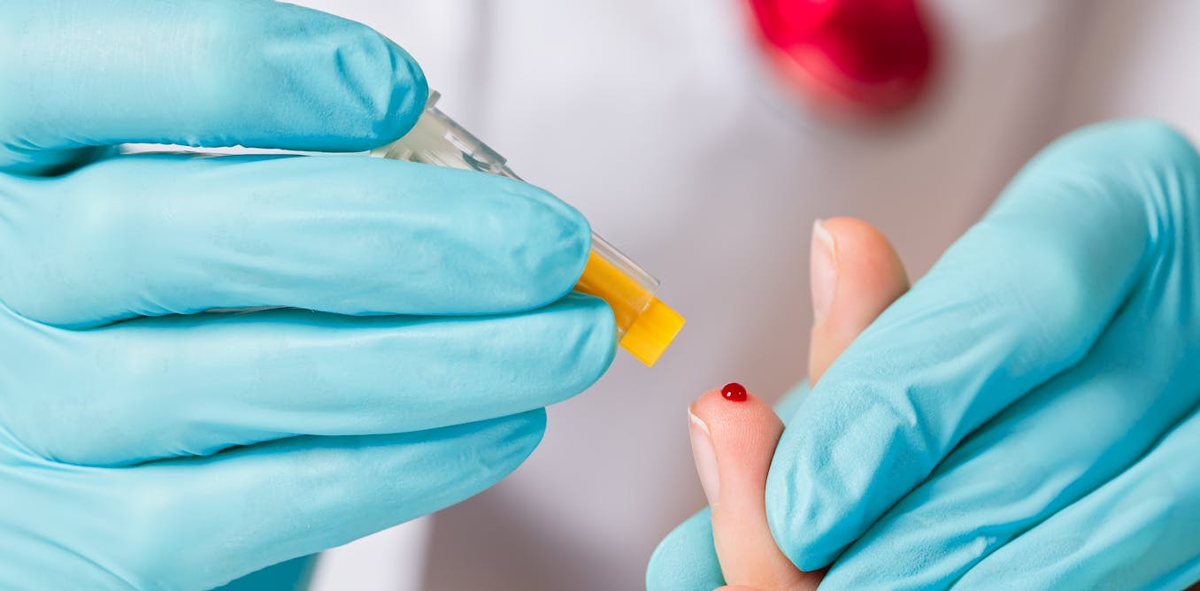 ¿Comemos lo que decimos? Una gota de sangre podría revelar la verdad sobre nuestra dieta