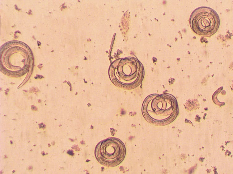 It is not simply anisakis: parasites that may make it on your plate (and how one can steer clear of them) 1 Several specimens of _Trichinella spiralis_, seen under the microscope.