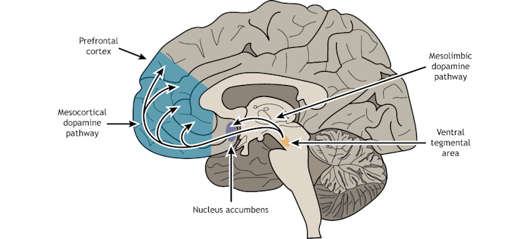 Diagram of cross-section of brain, with the front area colored blue and two small middle segments colored purple and orange