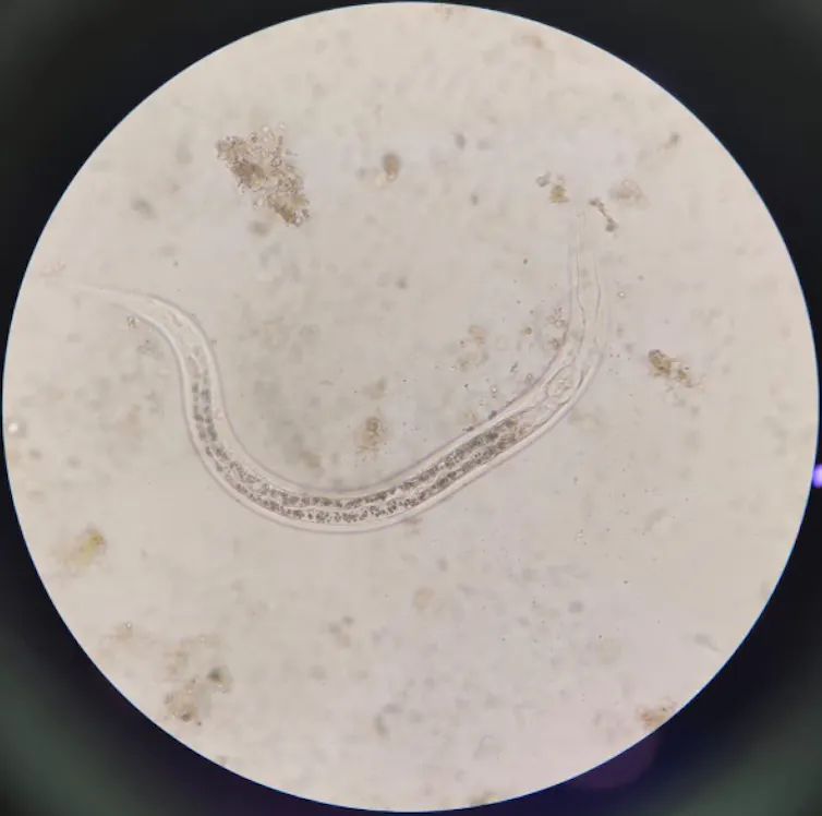 Penampakan cacing ‘Strongyloides stercoralis’ melalui mikroskop.