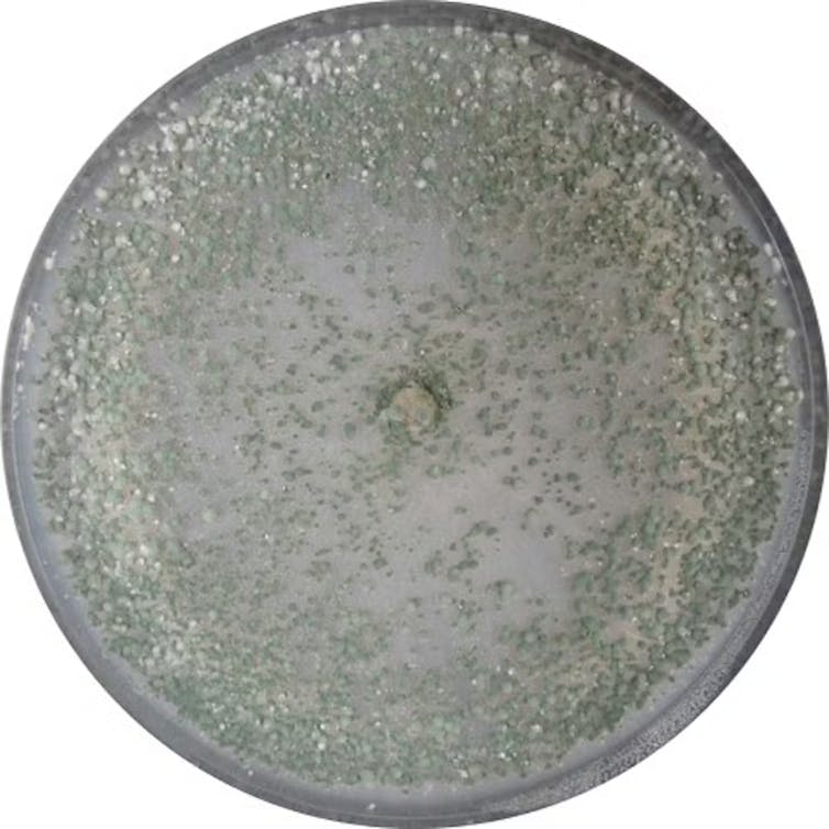 Un nuevo sistema inmunológico vegetal es "similar" al humano, según revela un estudio 1 file 20260118 56 o2e4lf.jpg?ixlib=rb 4.1