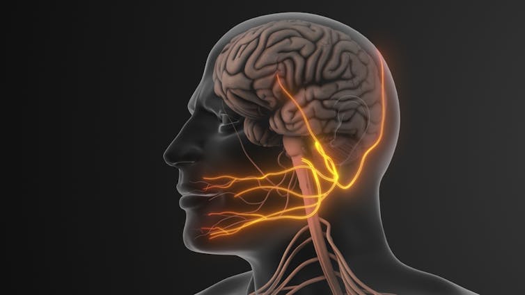 A graphic showing the trigeminal nerve.