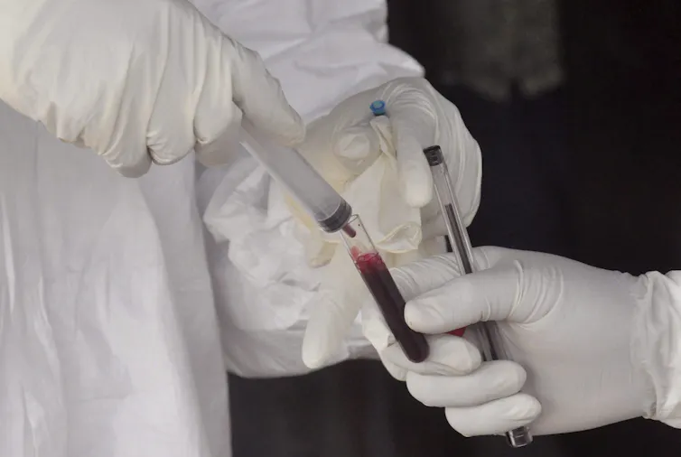 Des agents de santé prélèvent un échantillon sanguin