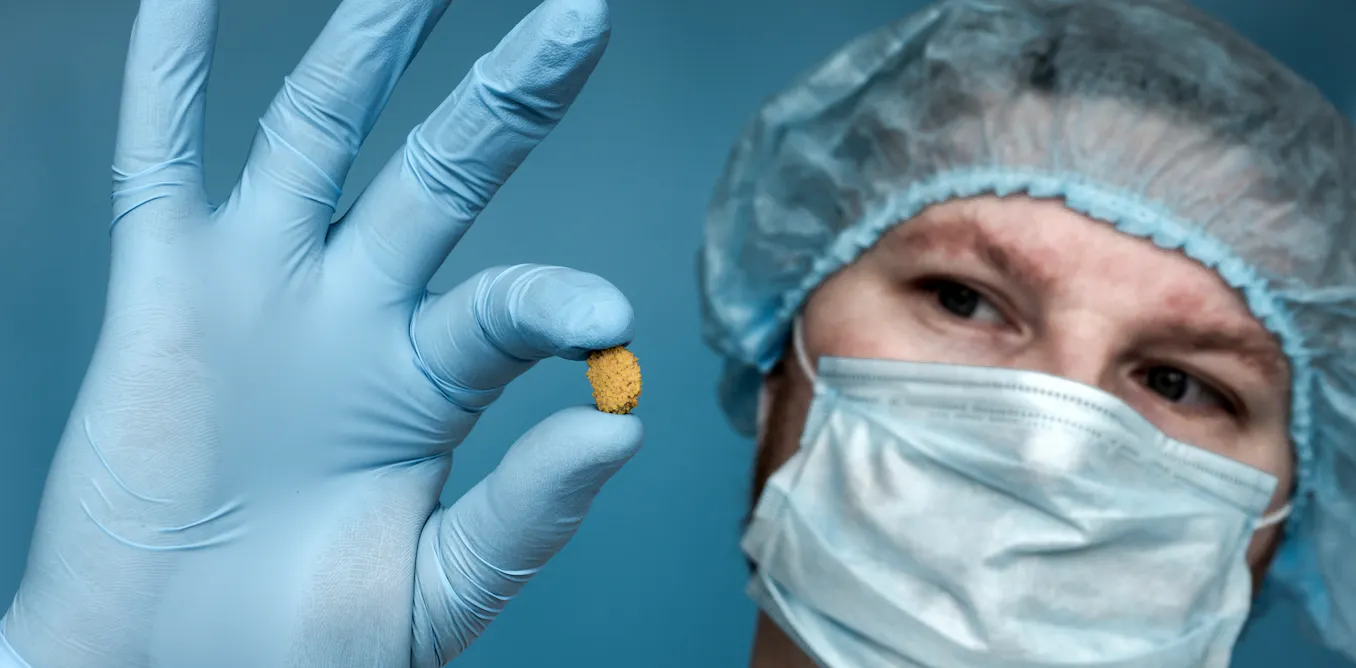 where and why your body makes stones where and why your body makes stones