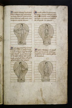 Menstruation and Childbirth within the Center Ages: Between Worry and Superstition 1 file 20260126 66 26xbyf.jpg?ixlib=rb 4.1