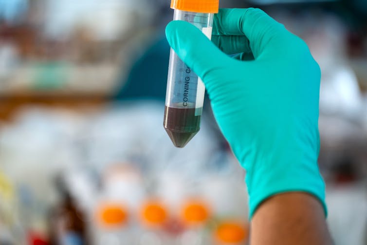 A gloved hand holding a tube containing reddish-green liquid.