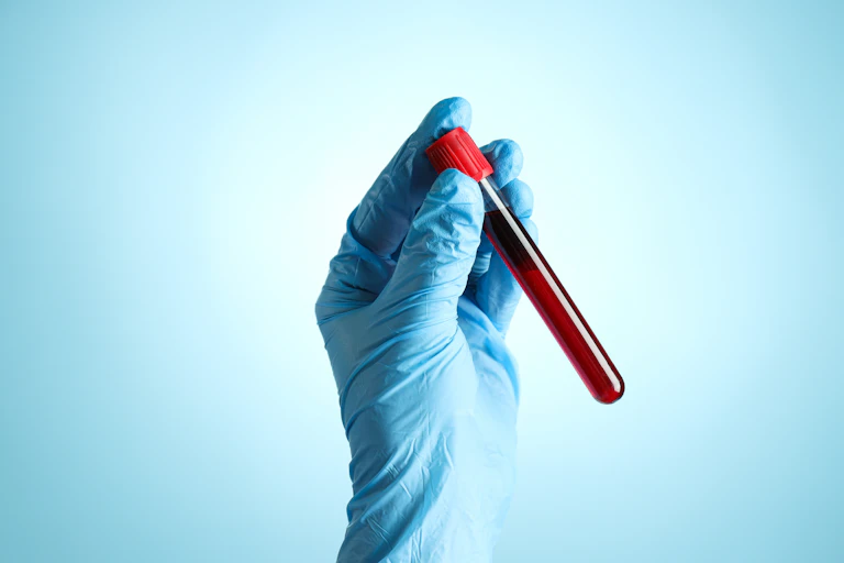 A hand wearing a blue surgical glove holds a vial of blood.