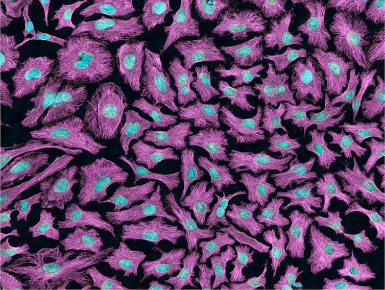 Microscopie à fluorescence de cellules HeLa (les microtubules du cytosquelette sont indiqués en magenta et l’ADN, en bleu cyan).