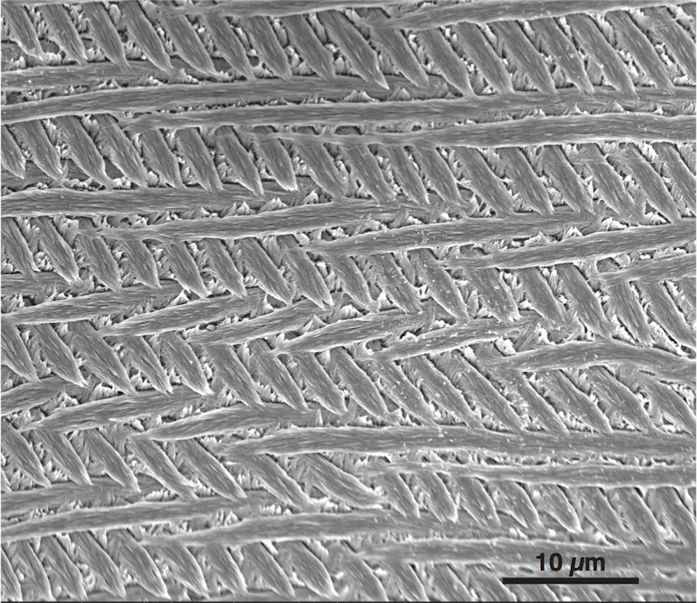 Tooth Structure Nano Studying tooth enamel nanostructure may lead to less time with the ...