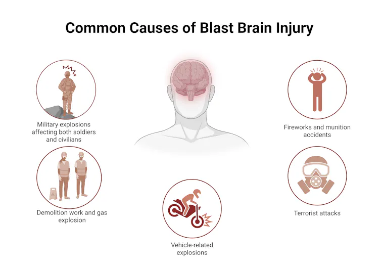 Diagram of common causes of brain blast injuries