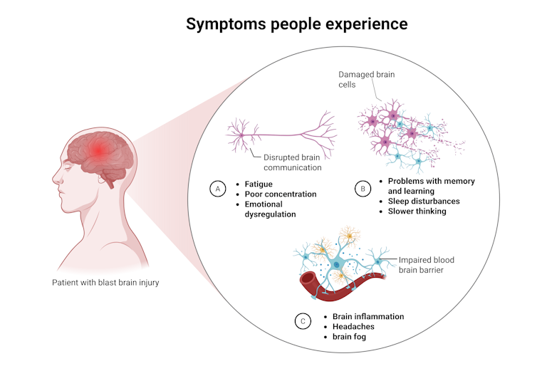 Diagram of symptoms associated with brain injury