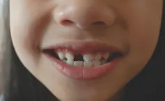 Primeros auxilios dentales: cómo salvar un diente después de un golpe 1 file 20260212 56 6wxz78.jpg?ixlib=rb 4.1