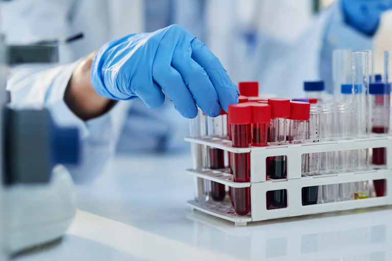 Blood samples in a laboratory setting.