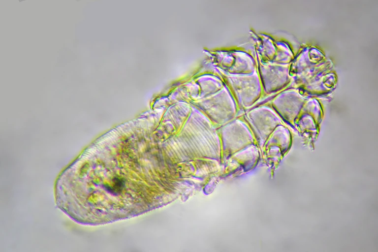 Close up of demodex follicolorum