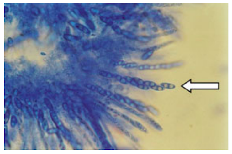 Microscopy image of blue fuzzy sphere with long extensions