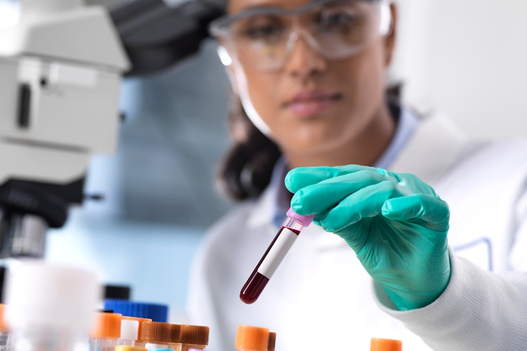 Researcher wearing a white labcoat and glasses holds a test tube.