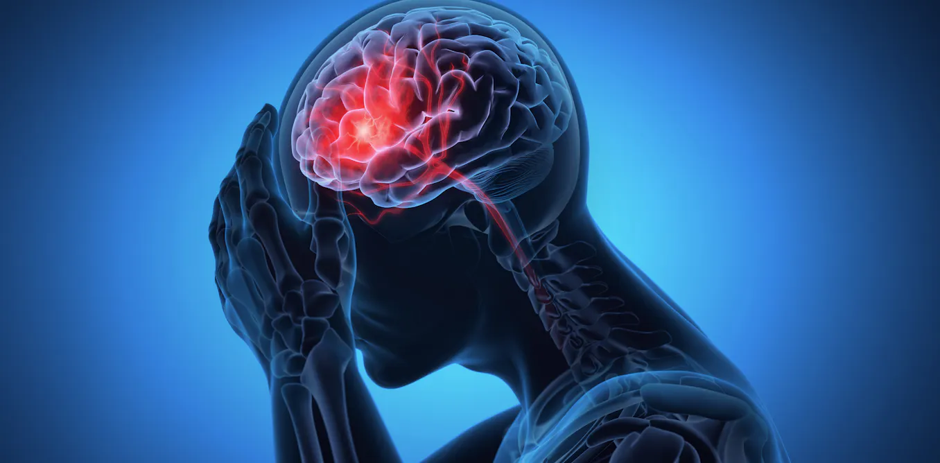 Not just sport and car crashes: debunking 5 myths about traumatic brain injury in NZ (via theconversation.com)
