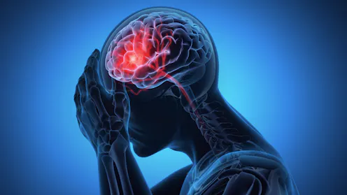 Brain injury – News, Research and Analysis – The Conversation – page 1