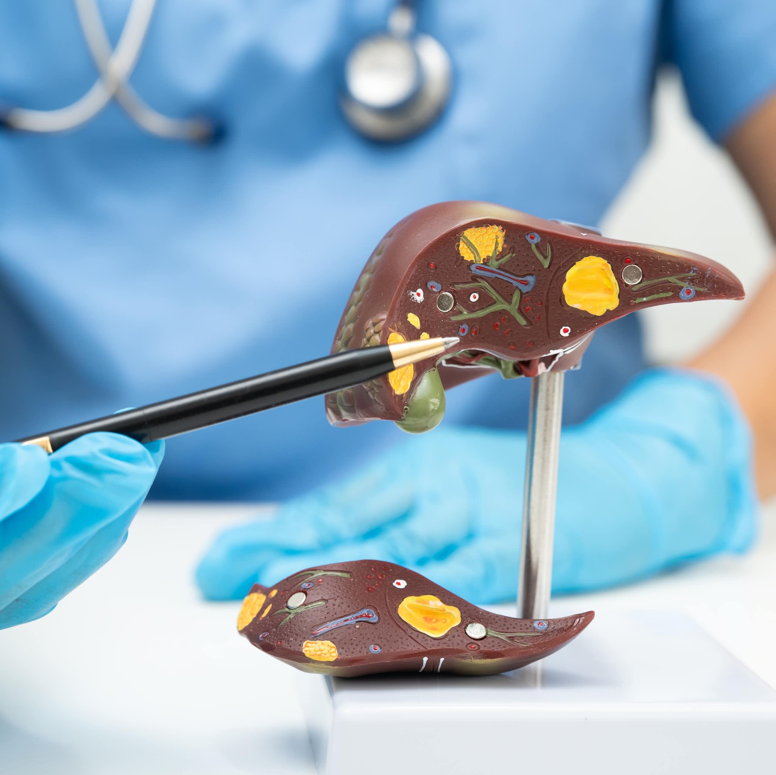 Una persona vestida de metge davant d'un fetge de plàstic