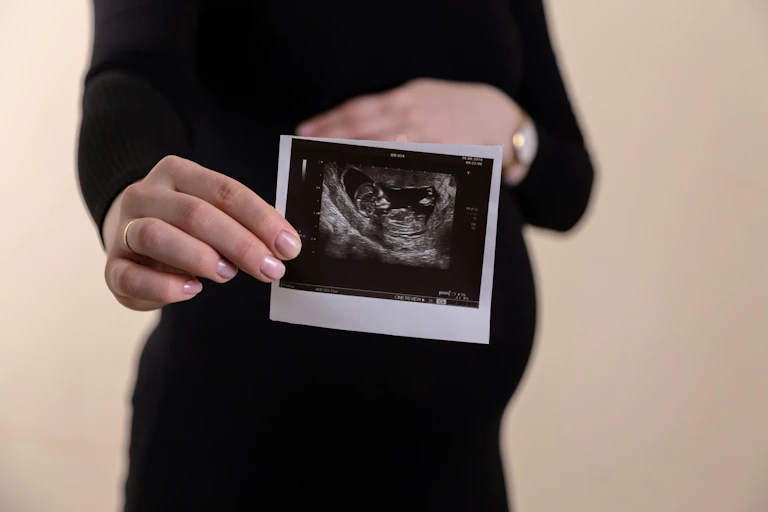 A pregnant woman holding an ultrasound image in the foreground