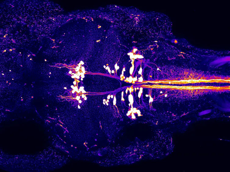 Microscopy image of violet, symmetrical outline of the top of a fish with two white lines and nodules extending down its length