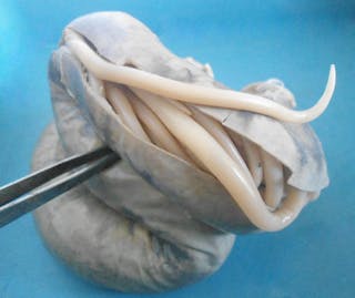 Health Check The Low Down On Worms And How To Get Rid Of Them
