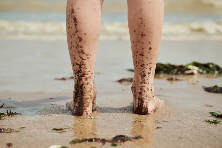 girl's feet on polluted beach