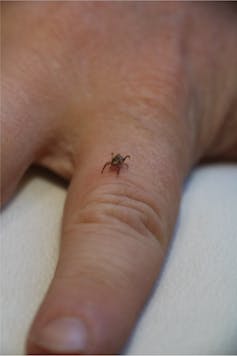 Tick on hand
