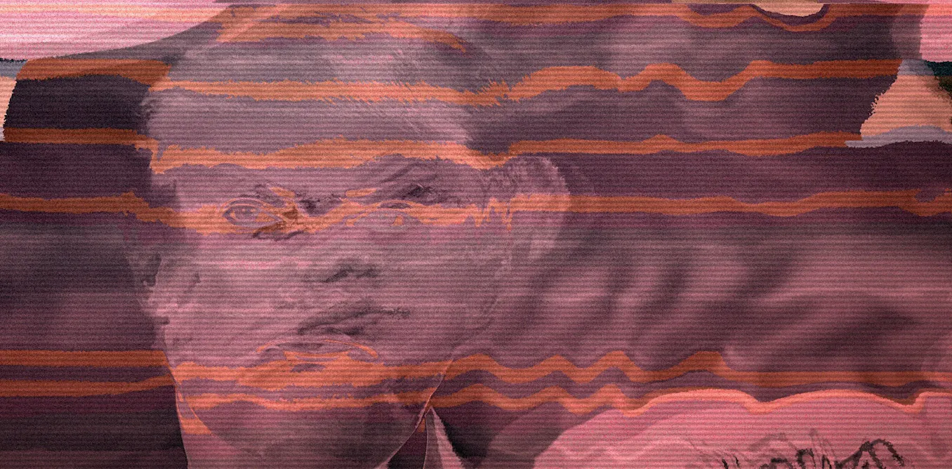 Exploding head syndrome: the surprisingly common condition with a ...