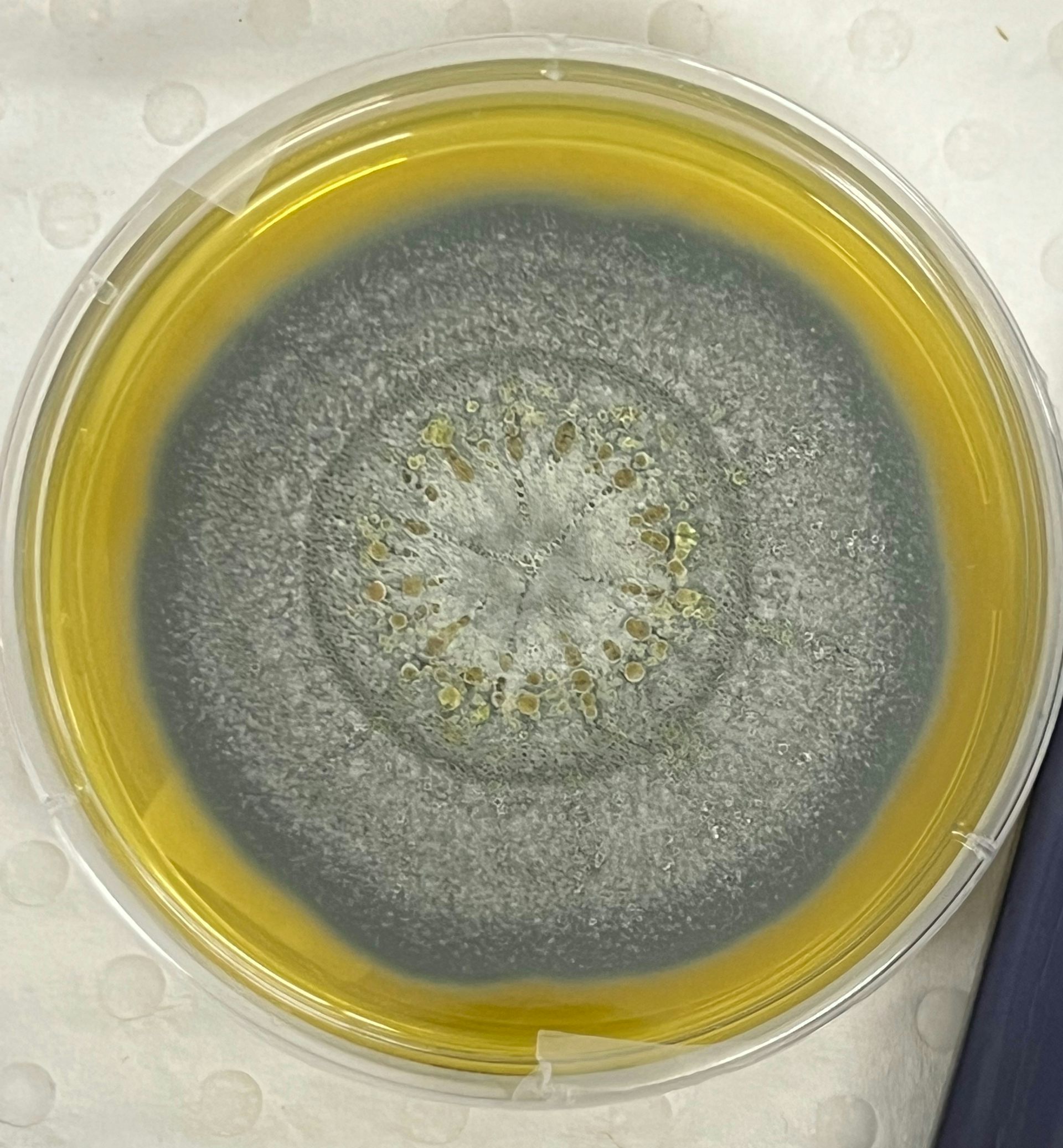 What is Aspergillus, the fungus behind recent hospital deaths?