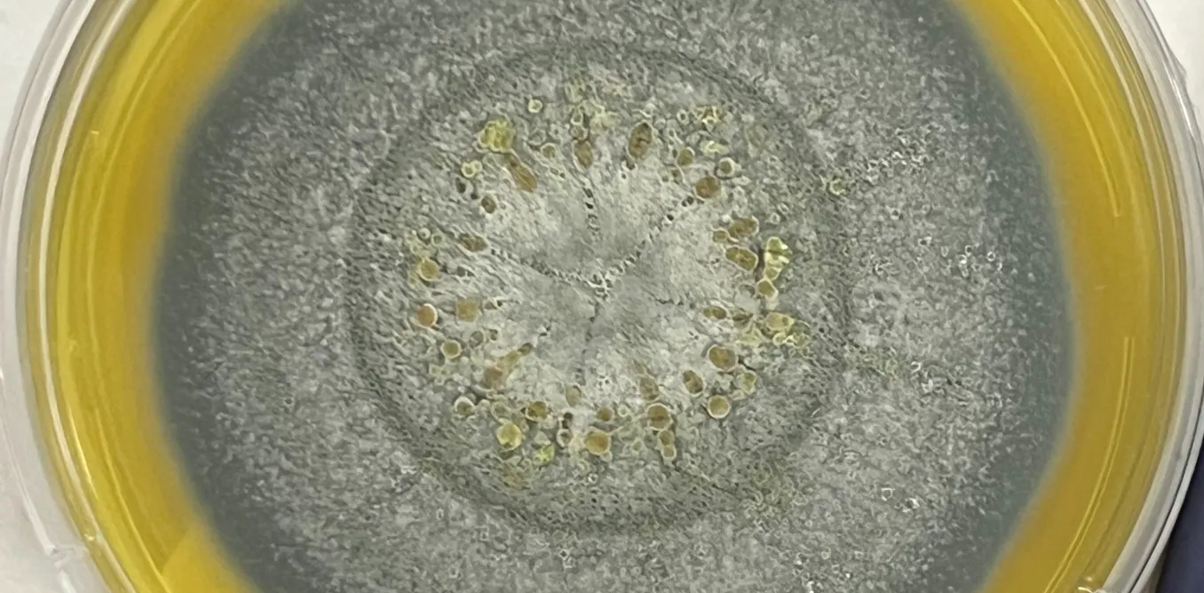 What is Aspergillus, the fungus behind recent hospital deaths?