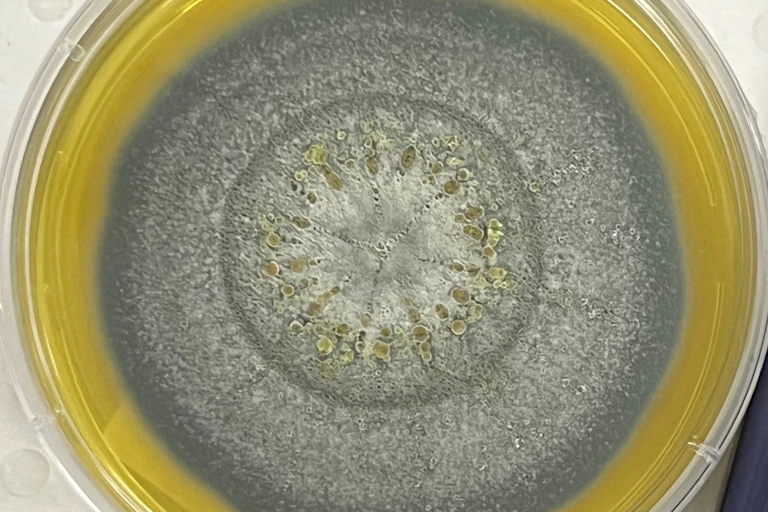 Close-up of a petri dish with a kind of mould