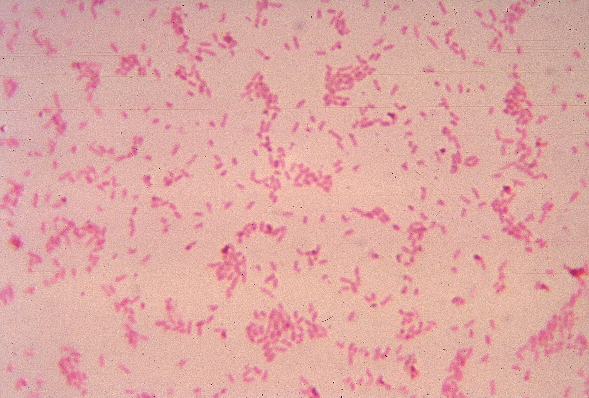 A micrograph of B fragilis.