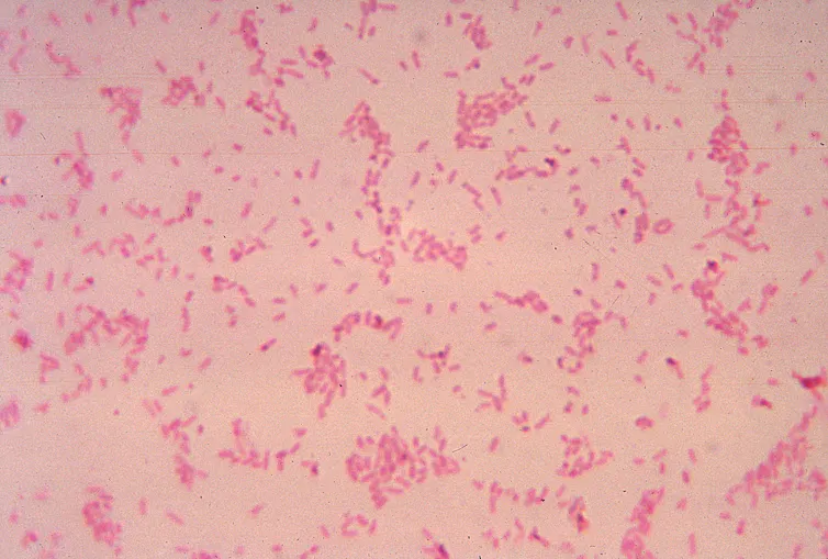 A micrograph of B fragilis.