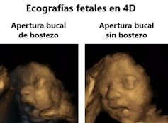 Why is it that after anyone yawns, their yawn infects us? 2 file 20260305 57 gpqvlm.jpg?ixlib=rb 4.1