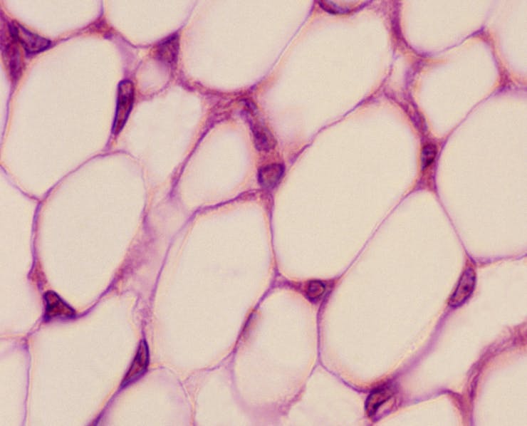 Microscopy image of oval-shaped white blobs packed together