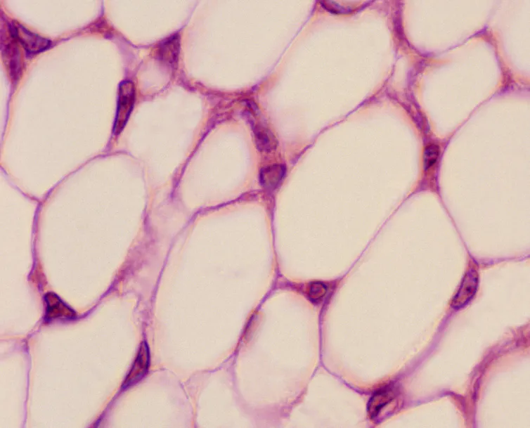 Microscopy image of oval-shaped white blobs packed together
