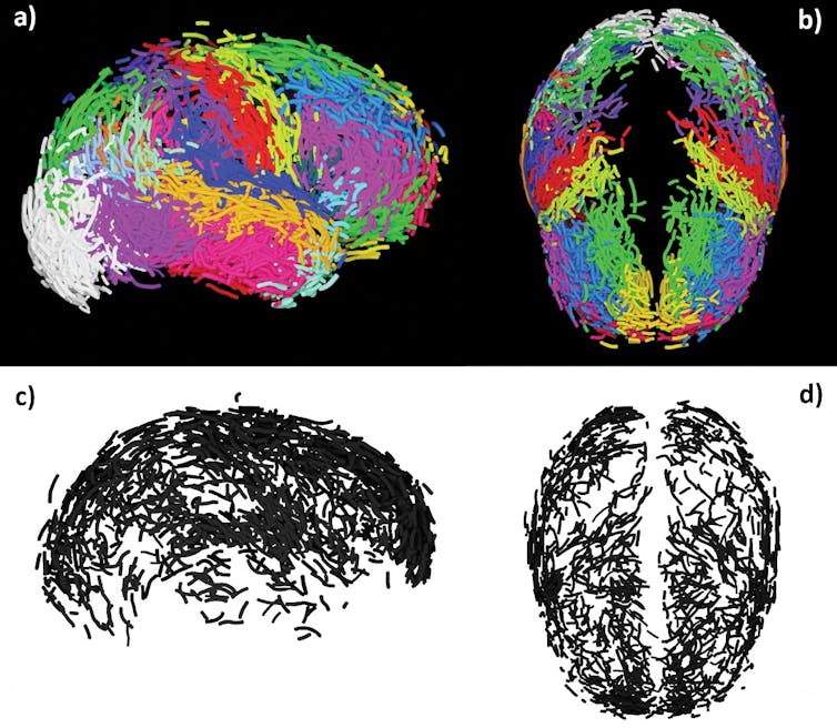 Vue latérale droite de l’ensemble des empreintes liées aux sillons cérébraux observées sur les 75 endocrânes