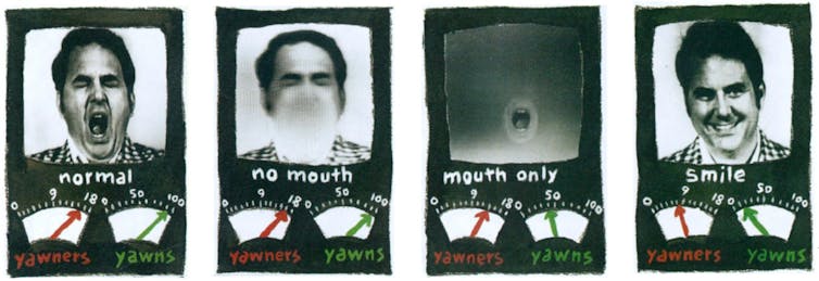 Why is it that after anyone yawns, their yawn infects us? 3 file 20260307 57 gdztjy.jpg?ixlib=rb 4.1