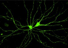 Neurona de melanopsina teñida con inmunofluorescencia.