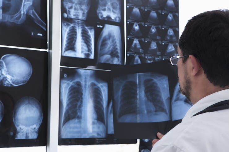 view from behind of man looking at X-rays of chest and other body parts
