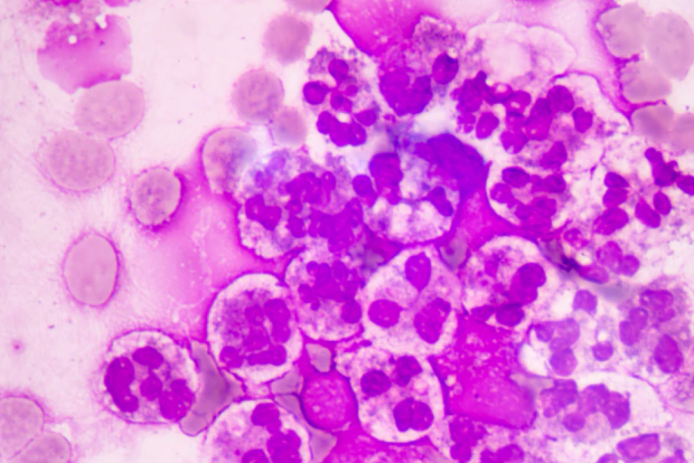 Microscopic image of neutrophils, immune cells that flood areas of infection.