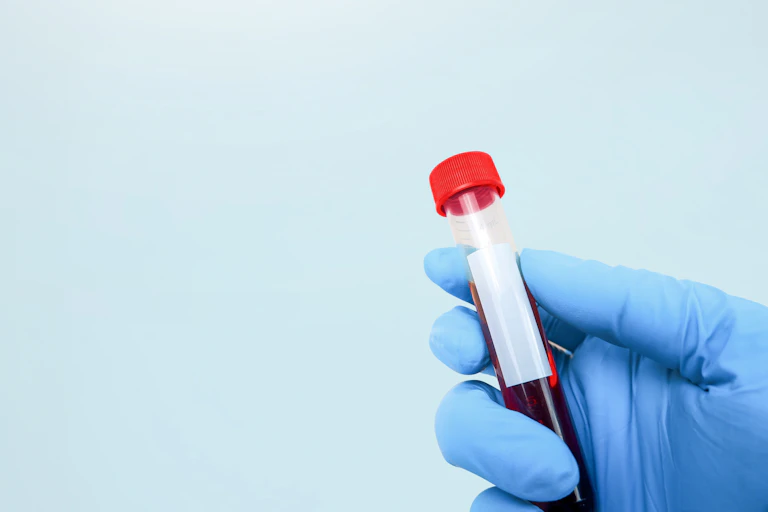 A gloved hand holding a tube of blood.