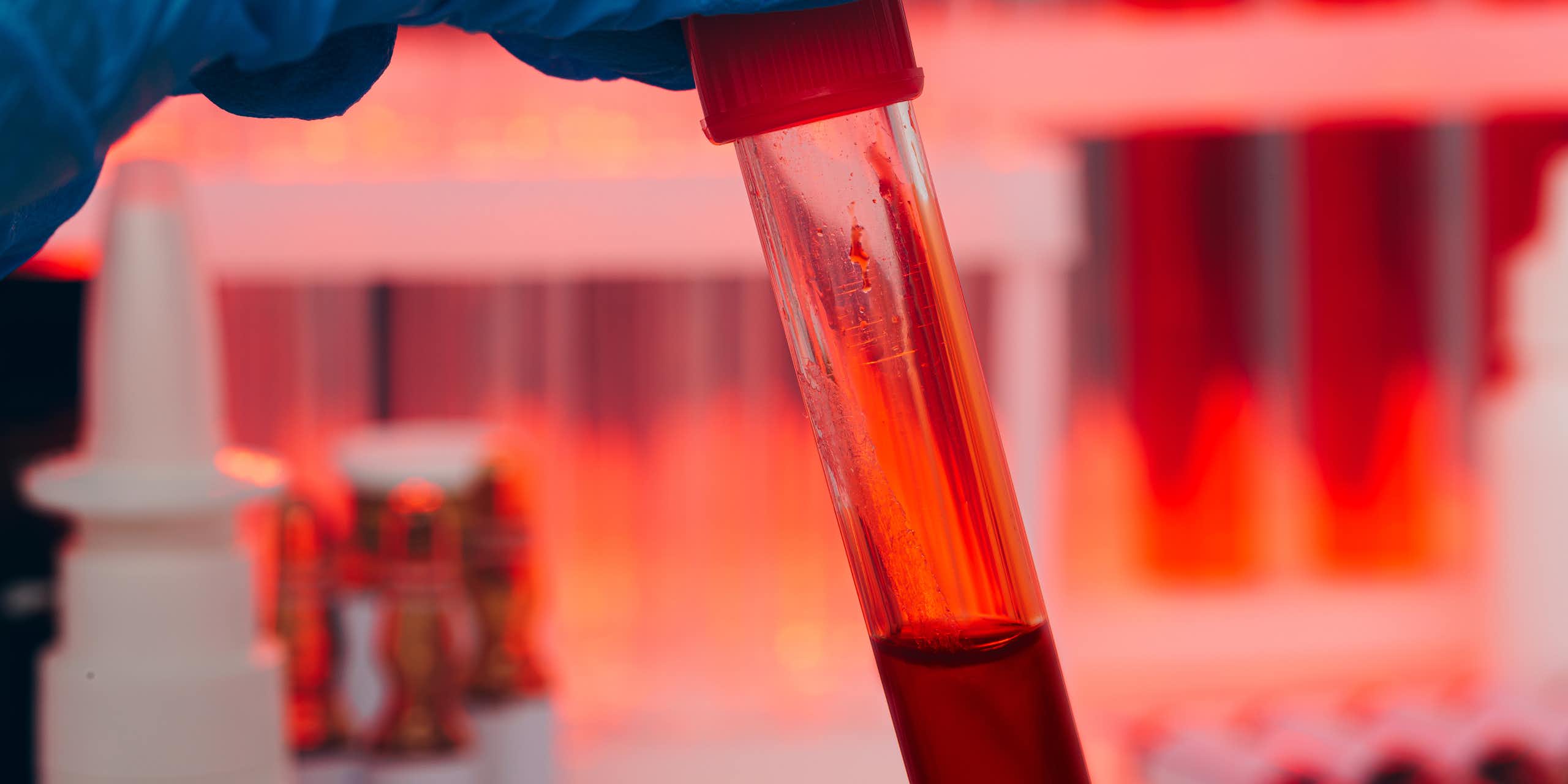 Photo of a gloved hand holding a test tube half full of blood.